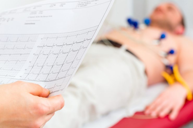 ECG Testing